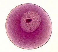 血性白帶的癥狀表現