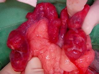 女性子宮內膜炎的常規檢查