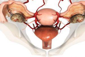 盆腔積液檢查方法