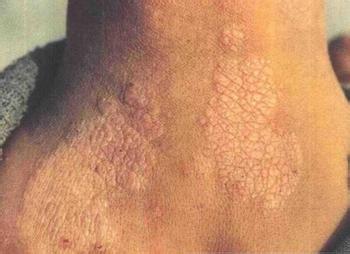 南通華醫堂皮膚醫院