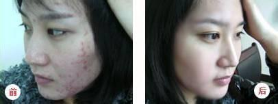 南通華醫堂皮膚醫院