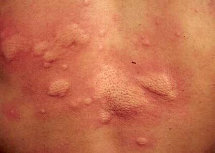 南通華醫堂皮膚醫院