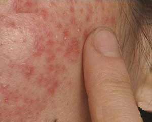 南通華醫堂皮膚醫院