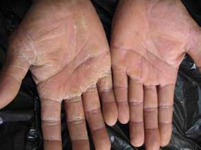 南通華醫堂皮膚醫院