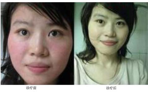 南通華醫(yī)堂皮膚醫(yī)院