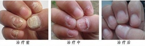 南通華醫(yī)堂皮膚醫(yī)院