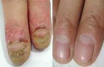 南通華醫(yī)堂皮膚醫(yī)院