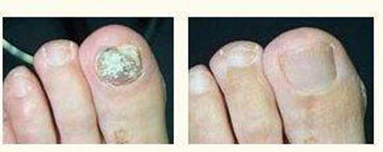 南通華醫堂皮膚醫院