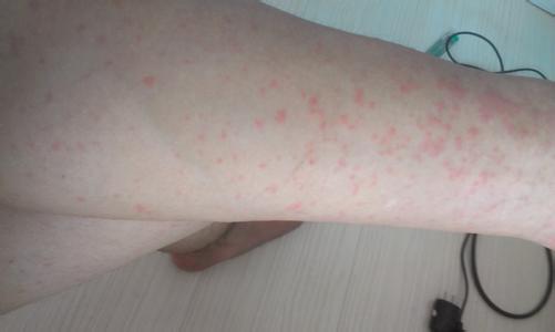 南通華醫堂皮膚醫院