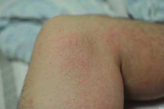 南通華醫堂皮膚醫院