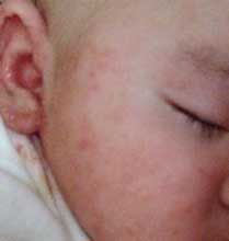 南通華醫(yī)堂皮膚醫(yī)院