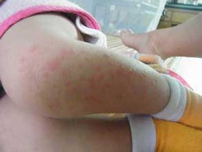 南通華醫(yī)堂皮膚醫(yī)院