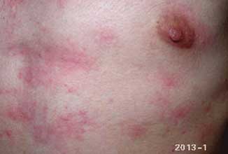 南通華醫(yī)堂皮膚醫(yī)院