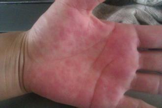 南通華醫(yī)堂皮膚醫(yī)院