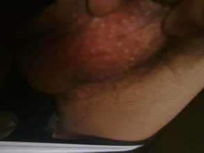 南通華醫(yī)堂皮膚醫(yī)院