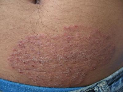 南通華醫堂皮膚醫院