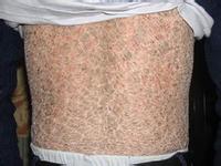 南通華醫(yī)堂皮膚醫(yī)院