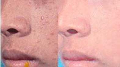 南通華醫堂皮膚醫院