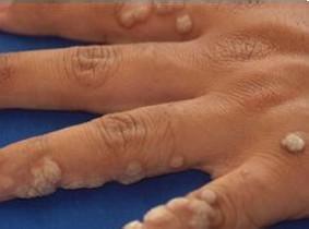 南通華醫堂皮膚醫院