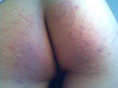 南通華醫(yī)堂皮膚醫(yī)院