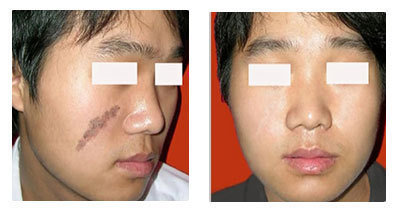 南通華醫(yī)堂皮膚醫(yī)院